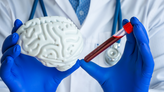 Person in doctors coat holds a model brain next to a red vial.