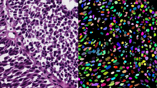 Two images of cells from a microscope. On the left is the raw image, on the right the cells are overlaid with colors identifying them.